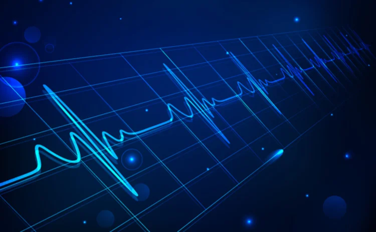 Integrating stress testing with risk managment